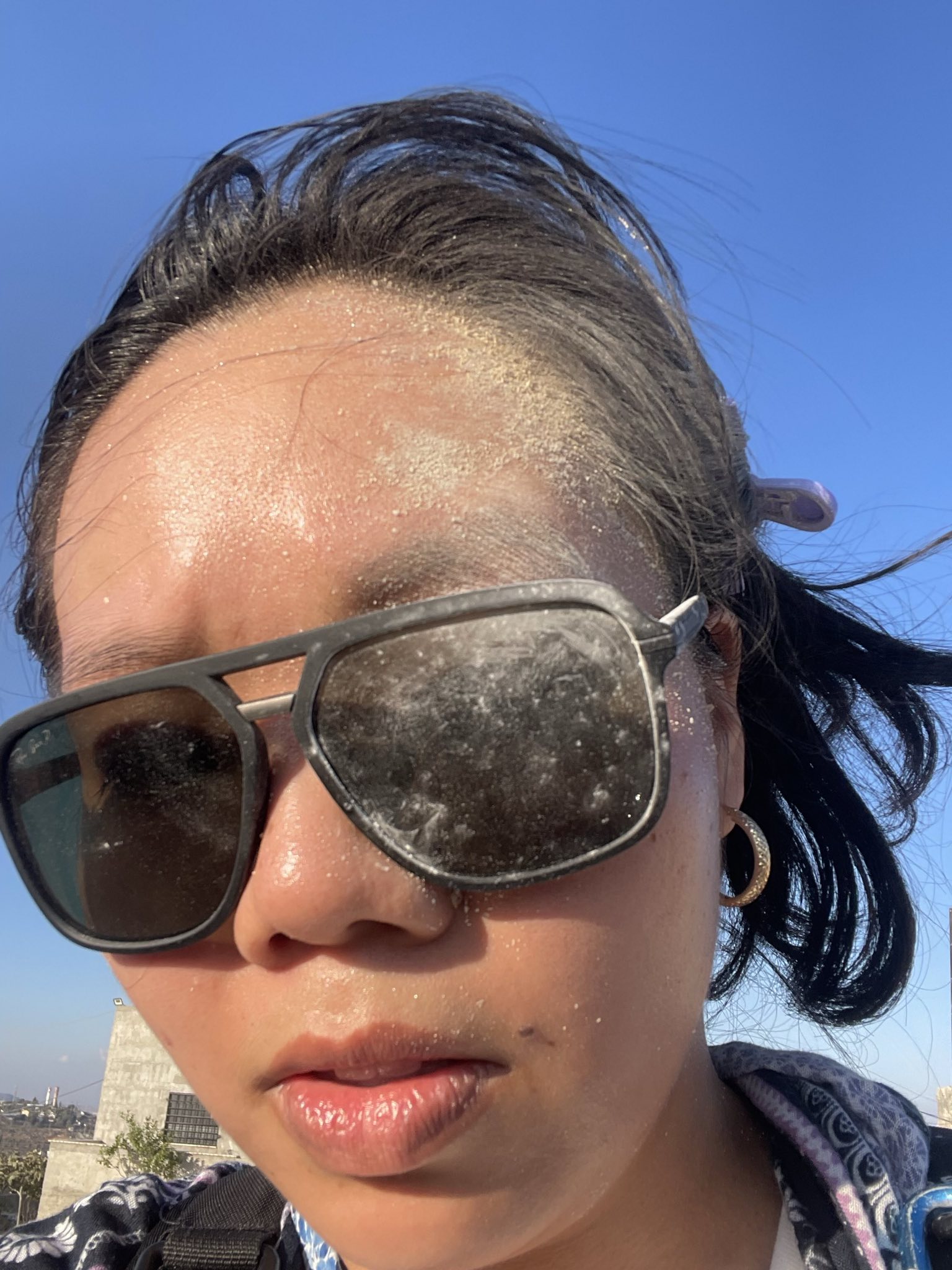 American volunteer Vivi Chen after being hit in the face with a stone